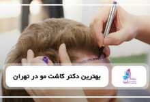 بهترین دکتر کاشت مو در تهران