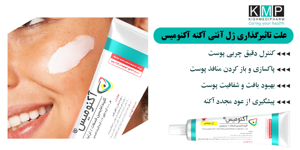 علت اثر گذاری آکنومیس