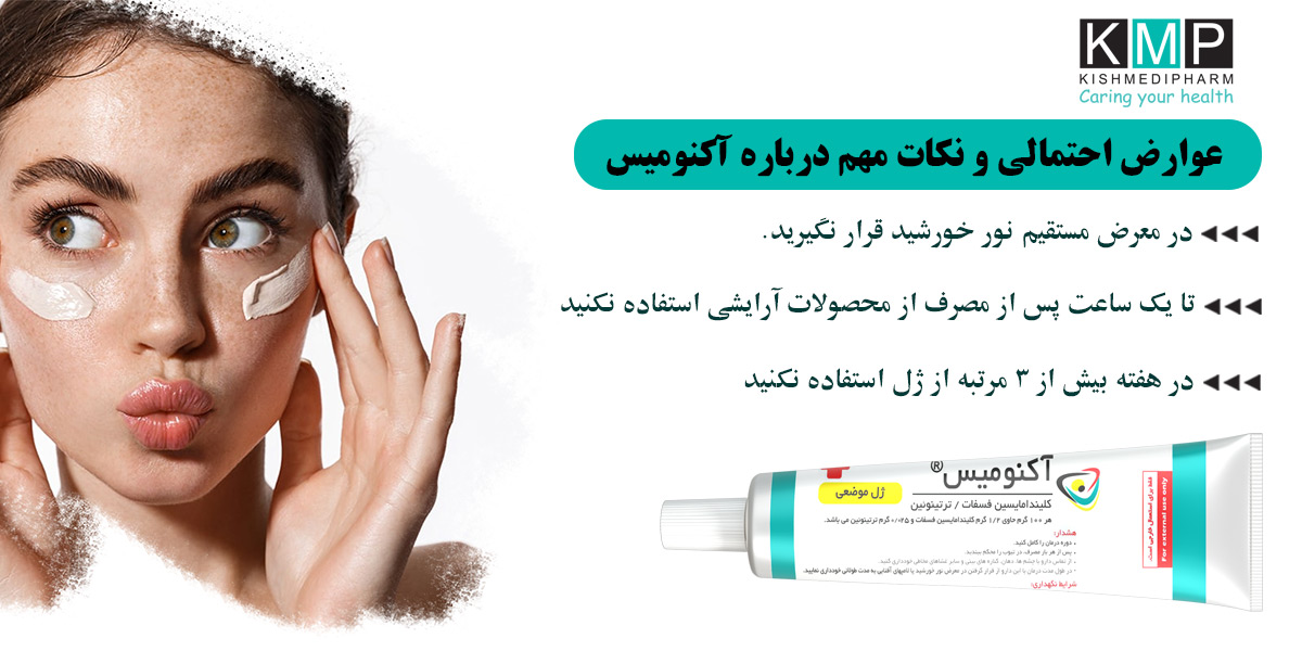 نکات در مورد آکنومیس