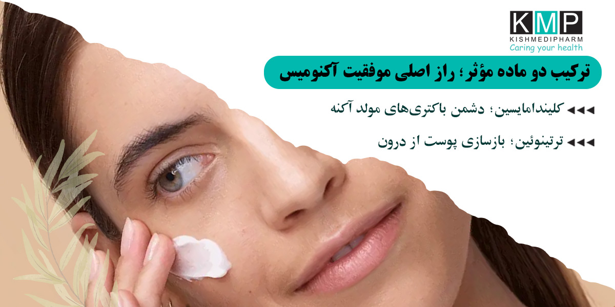 ترکیبات آکنومیس