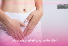 انواع جراحی زیبایی لبهای بیرونی در زنان