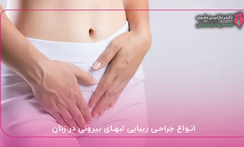 انواع جراحی زیبایی لبهای بیرونی در زنان