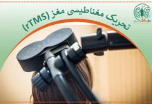 درمان وسواس با rTMS