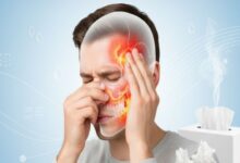 سینوزیت چیست