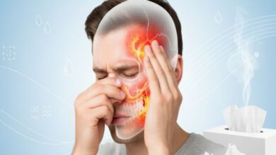 سینوزیت چیست