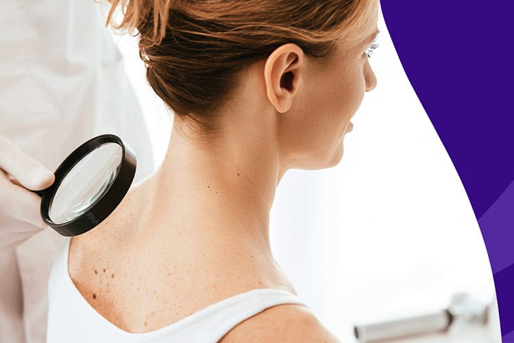 کرم ضد آفتاب