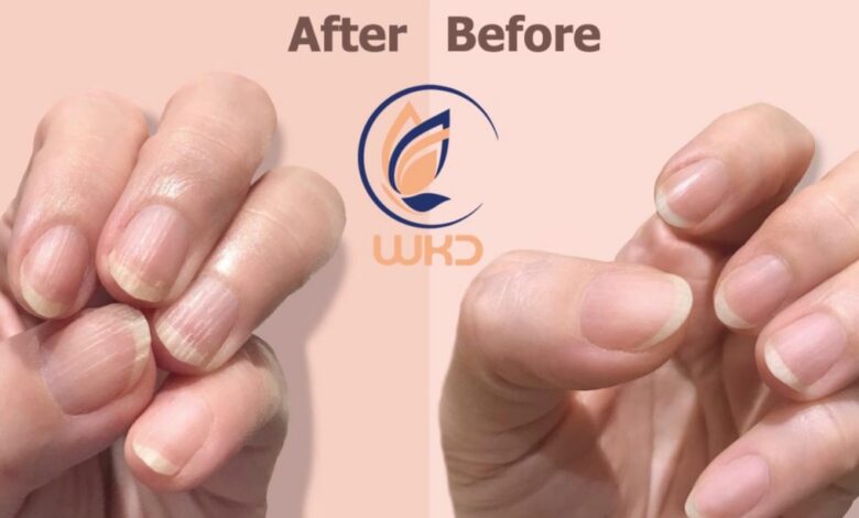 روغن ناخن و کوتیکول WKD، انتخابی ایدهآل برای مراقبت از ناخنها
