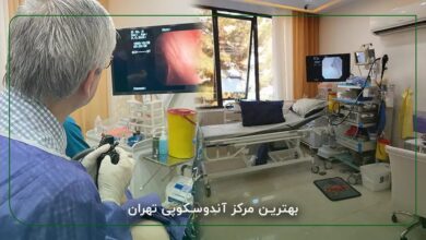 بهترین مرکز آندوسکوپی معده