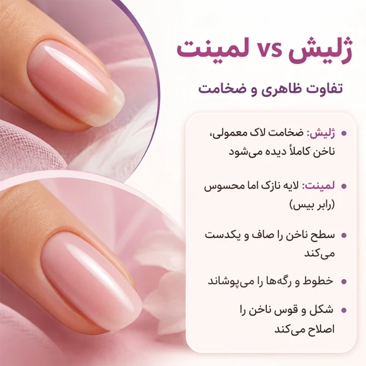 تفاوت در میزان ضخامت و ظاهر لمینت و ژلیش