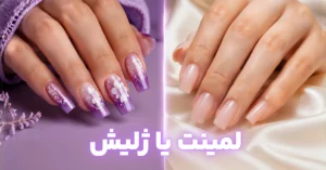 تفاوت لمینت و ژلیش: کدام روش را انتخاب کنیم ؟