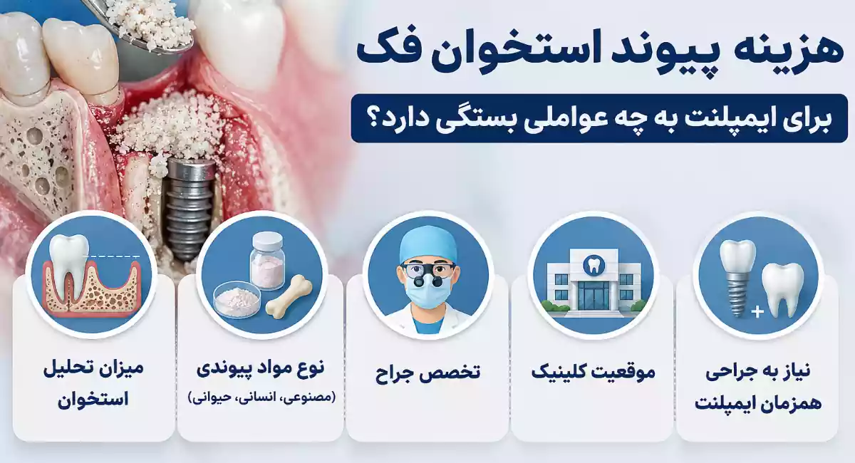 قیمت پیوند استخوان برای ایمپلنت به چه عواملی بستگی دارد