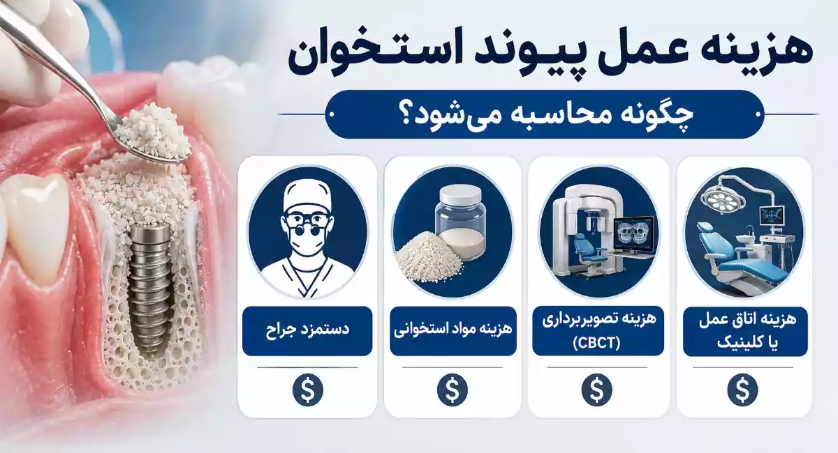 قیمت عمل پیوند استخوان چگونه محاسبه می شود؟