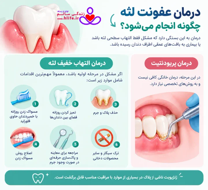 درمان عفونت لثه چگونه انجام میشود؟
