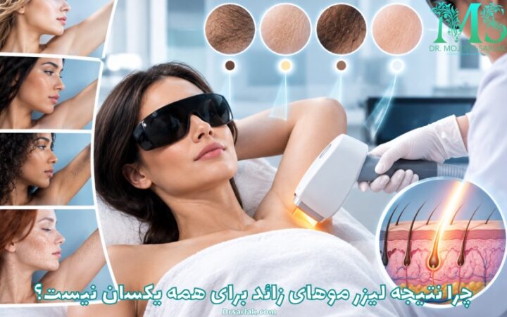 چرا نتیجه لیزر موهای زائد برای همه یکسان نیست؟