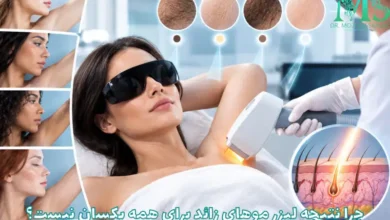 چرا نتیجه لیزر موهای زائد برای همه یکسان نیست؟