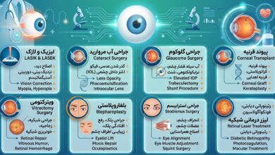 انواع عمل چشم