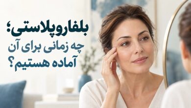 بلفاروپلاستی